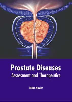 Prostate Diseases: Evaluacion Y Terapéutica - Prostate Diseases: Assessment and Therapeutics