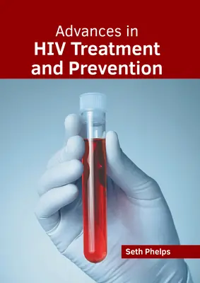 Avances en el tratamiento y la prevención del VIH - Advances in HIV Treatment and Prevention