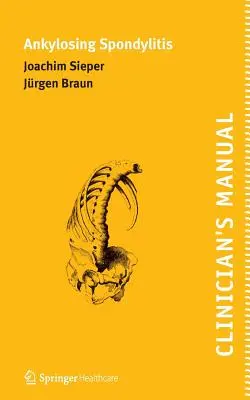 Manual clínico de la espondilitis anquilosante - Clinician's Manual on Ankylosing Spondylitis