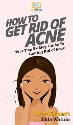 Cómo deshacerse del acné: Su guía paso a paso para deshacerse del acné - How To Get Rid of Acne: Your Step By Step Guide To Getting Rid of Acne