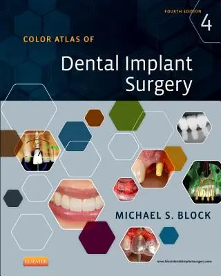 Atlas en color de cirugía de implantes dentales - Color Atlas of Dental Implant Surgery