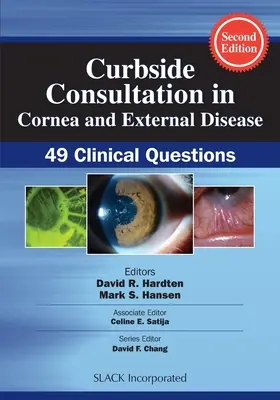 Consulta a pie de calle en córnea y enfermedades externas: 49 preguntas clínicas - Curbside Consultation in Cornea and External Disease: 49 Clinical Questions