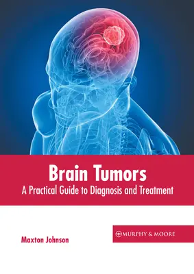 Tumores cerebrales: Guía práctica de diagnóstico y tratamiento - Brain Tumors: A Practical Guide to Diagnosis and Treatment