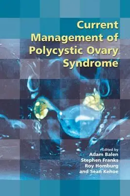 Manejo actual del síndrome de ovario poliquístico - Current Management of Polycystic Ovary Syndrome