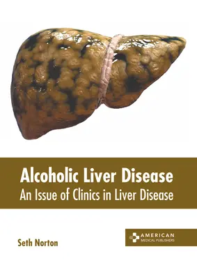 Enfermedad hepática alcohólica: Un número de Clinics in Liver Disease - Alcoholic Liver Disease: An Issue of Clinics in Liver Disease