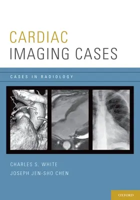 Casos de imagen cardiaca - Cardiac Imaging Cases