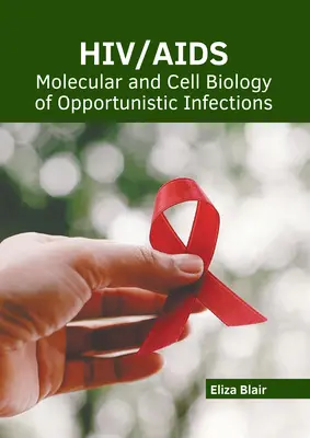 VIH/Sida: Biología molecular y celular de las infecciones oportunistas - Hiv/Aids: Molecular and Cell Biology of Opportunistic Infections