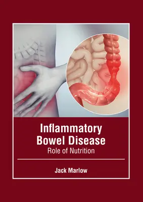 Enfermedad Inflamatoria Intestinal: El papel de la nutrición - Inflammatory Bowel Disease: Role of Nutrition