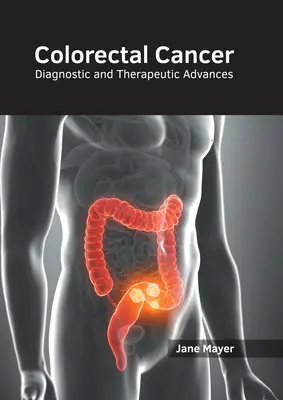 Cáncer colorrectal: Avances diagnósticos y terapéuticos - Colorectal Cancer: Diagnostic and Therapeutic Advances