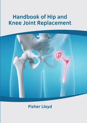 Manual de prótesis articulares de cadera y rodilla - Handbook of Hip and Knee Joint Replacement
