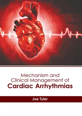 Mecanismo y tratamiento clínico de las arritmias cardíacas - Mechanism and Clinical Management of Cardiac Arrhythmias