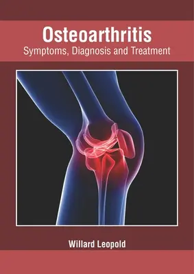 Osteoartritis: Síntomas, diagnóstico y tratamiento - Osteoarthritis: Symptoms, Diagnosis and Treatment