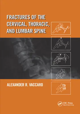 Fracturas de la columna cervical, torácica y lumbar - Fractures of the Cervical, Thoracic, and Lumbar Spine