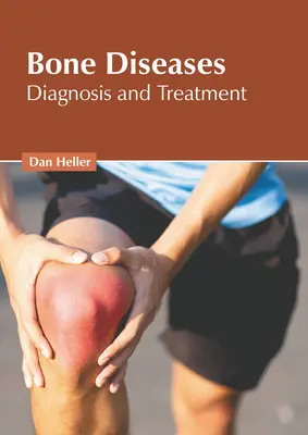 Enfermedades óseas: Diagnóstico y tratamiento - Bone Diseases: Diagnosis and Treatment