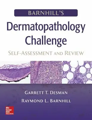 Barnhill's Dermatopathology Challenge: Autoevaluación y revisión - Barnhill's Dermatopathology Challenge: Self-Assessment & Review