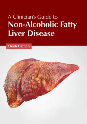 Guía clínica de la enfermedad hepática grasa no alcohólica - A Clinician's Guide to Non-Alcoholic Fatty Liver Disease