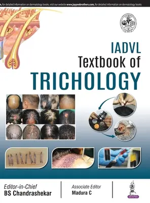 Libro de texto de tricología de la IADVL - IADVL Textbook of Trichology