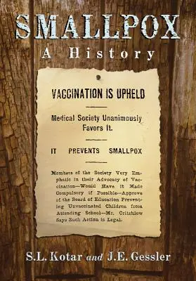 Viruela: Historia - Smallpox: A History