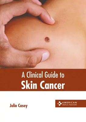 Guía clínica del cáncer de piel - A Clinical Guide to Skin Cancer