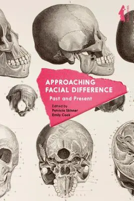 Aproximación a la diferencia facial: Pasado y presente - Approaching Facial Difference: Past and Present