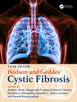 Fibrosis quística de Hodson y Geddes - Hodson and Geddes' Cystic Fibrosis