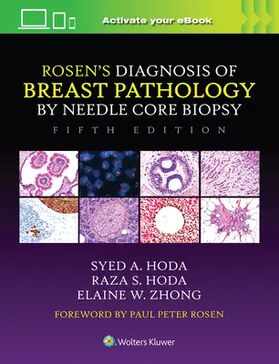 Rosen's Diagnosis of Breast Pathology by Needle Core Biopsy (Diagnóstico de la patología mamaria por biopsia con aguja gruesa de Rosen) - Rosen's Diagnosis of Breast Pathology by Needle Core Biopsy