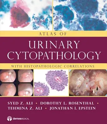Atlas de Citopatología Urinaria: Con Correlaciones Histopatológicas - Atlas of Urinary Cytopathology: With Histopathologic Correlations