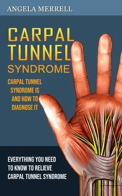 Síndrome del Túnel Carpiano: Qué es el Síndrome del Túnel Carpiano y Cómo Diagnosticarlo - Carpal Tunnel Syndrome: Carpal Tunnel Syndrome is and How to Diagnose It