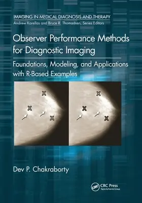 Observer Performance Methods for Diagnostic Imaging: Fundamentos, modelado y aplicaciones con ejemplos basados en R - Observer Performance Methods for Diagnostic Imaging: Foundations, Modeling, and Applications with R-Based Examples