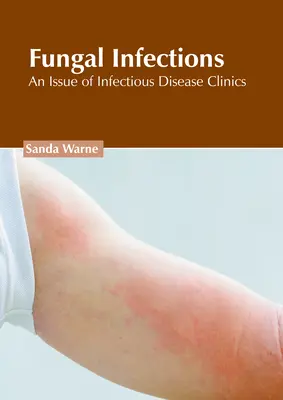 Infecciones fúngicas: Un número de Infectious Disease Clinics - Fungal Infections: An Issue of Infectious Disease Clinics