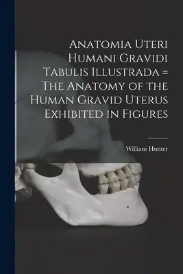 Anatomia Uteri Humani Gravidi Tabulis Illustrada = La anatomía del útero grávido humano expuesta en figuras - Anatomia Uteri Humani Gravidi Tabulis Illustrada = The Anatomy of the Human Gravid Uterus Exhibited in Figures