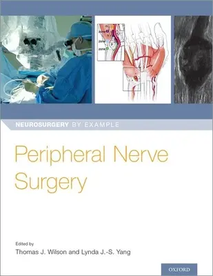 Cirugía de los nervios periféricos - Peripheral Nerve Surgery