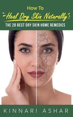 Cómo curar la piel seca de forma natural: Los 20 mejores remedios caseros para la piel seca - How to Heal Dry Skin Naturally: The 20 Best Dry Skin Home Remedies