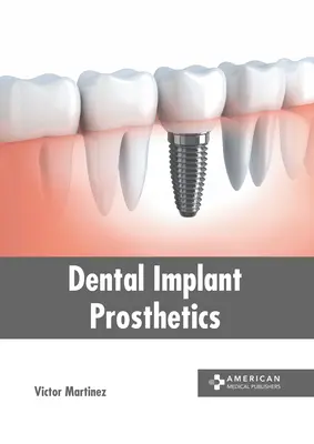 Prótesis sobre implantes dentales - Dental Implant Prosthetics