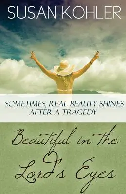 Hermosa a los ojos del Señor: A veces, la verdadera belleza brilla después de una tragedia - Beautiful in the Lord's Eyes: Sometimes, Real Beauty Shines After A Tragedy