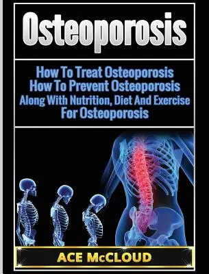 Osteoporosis: Cómo Tratar La Osteoporosis: Cómo Prevenir La Osteoporosis: Cómo Tratar La Osteoporosis: Cómo Prevenir La Osteoporosis: Nutrición, Dieta Y Ejercicio Para La Osteoporosis - Osteoporosis: How To Treat Osteoporosis: How To Prevent Osteoporosis: Along With Nutrition, Diet And Exercise For Osteoporosis