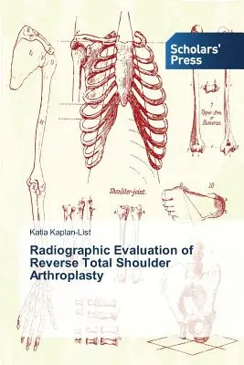 Evaluación radiográfica de la artroplastia total de hombro invertida - Radiographic Evaluation of Reverse Total Shoulder Arthroplasty