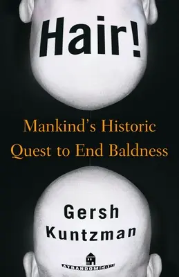 ¡Pelo! La búsqueda histórica de la humanidad para acabar con la calvicie - Hair!: Mankind's Historic Quest to End Baldness