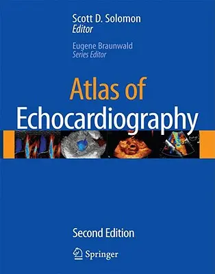 Atlas de ecocardiografía [Con CDROM] - Atlas of Echocardiography [With CDROM]