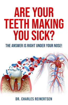 ¿Sus dientes le ponen enfermo?: La respuesta está delante de sus narices - Are Your Teeth Making You Sick?: The Answer Is Right Under Your Nose