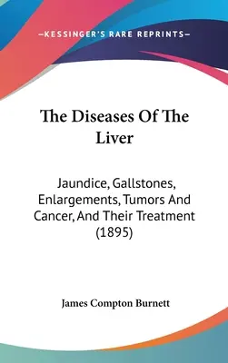 Las enfermedades del hígado: Ictericia, cálculos biliares, agrandamientos, tumores y cáncer, y su tratamiento (1895) - The Diseases Of The Liver: Jaundice, Gallstones, Enlargements, Tumors And Cancer, And Their Treatment (1895)