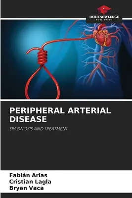 Enfermedad arterial periférica - Peripheral Arterial Disease