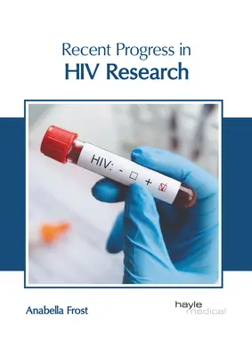 Avances recientes en la investigación del VIH - Recent Progress in HIV Research