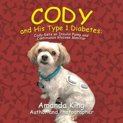 Cody y su diabetes de tipo 1: Cody consigue una bomba de insulina y un monitor continuo de glucosa - Cody and His Type 1 Diabetes: Cody Gets an Insulin Pump and Continuous Glucose Monitor