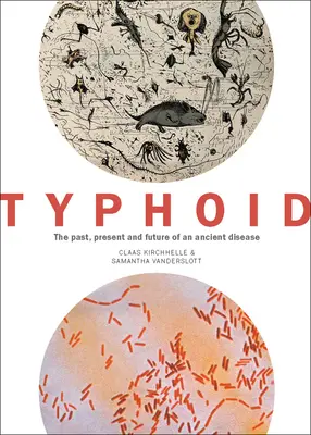 La fiebre tifoidea: Pasado, presente y futuro de una antigua enfermedad - Typhoid: The Past, Present, and Future of an Ancient Disease