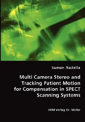 Multi Camera Stereo and Tracking Patient Motion for Compensation in SPECT Scanning Systems (Estereoscopia multicámara y seguimiento del movimiento del paciente para compensación en sistemas de exploración SPECT) - Multi Camera Stereo and Tracking Patient Motion for Compensation in SPECT Scanning Systems