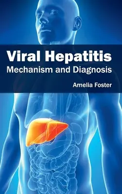 Hepatitis vírica: Mecanismo y diagnóstico - Viral Hepatitis: Mechanism and Diagnosis