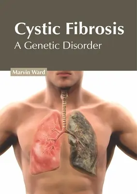 Fibrosis quística: Un trastorno genético - Cystic Fibrosis: A Genetic Disorder