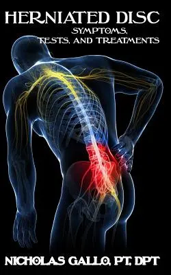 Hernia discal: Síntomas, pruebas y tratamientos - Herniated Disc: Symptoms, Tests, and Treatments