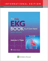 El único libro de electrocardiogramas que necesitará - Only EKG Book You'll Ever Need